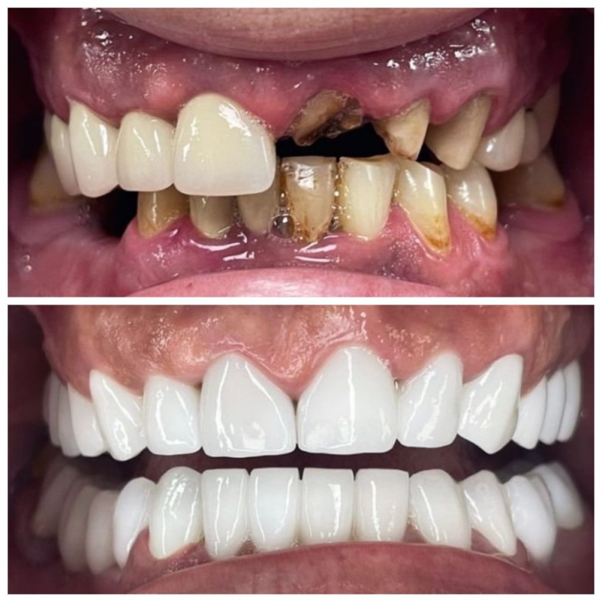 before and after photo