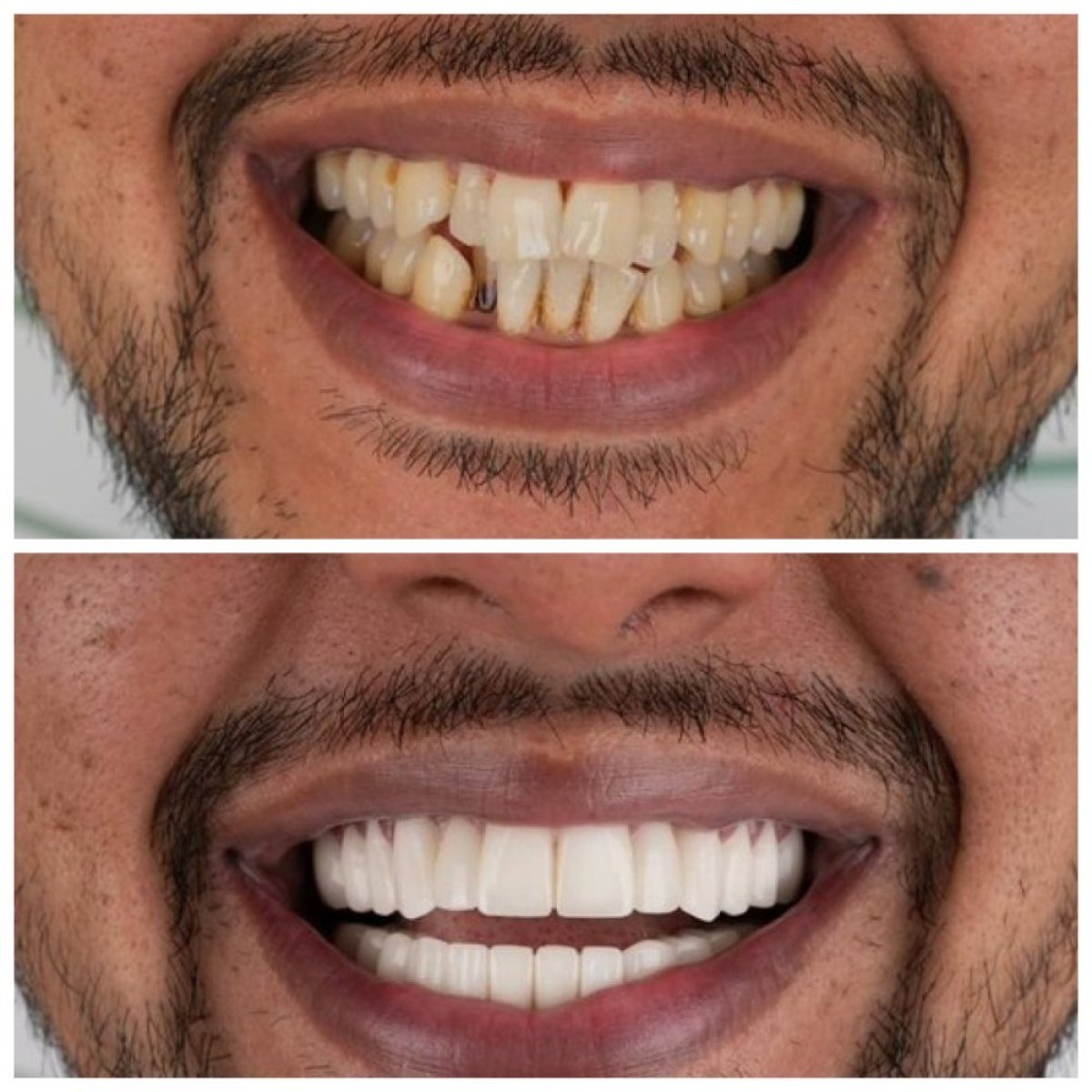 before and after photo