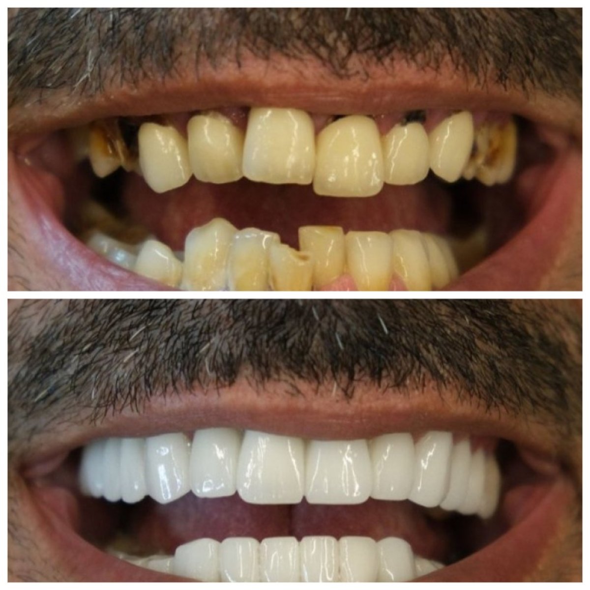 before and after photo