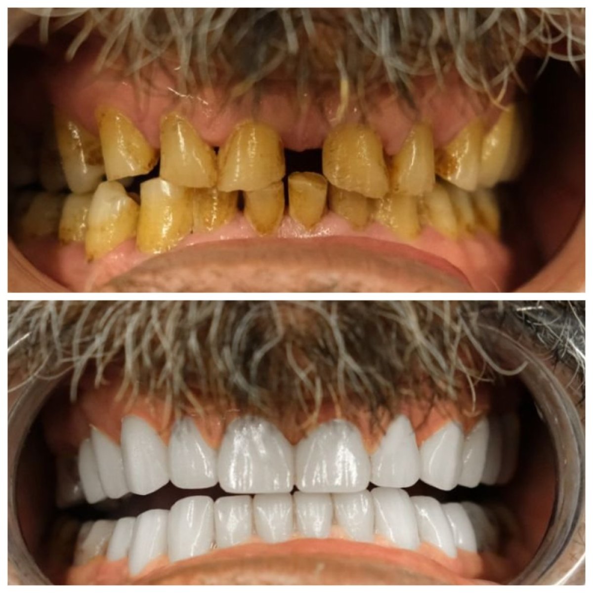 before and after photo