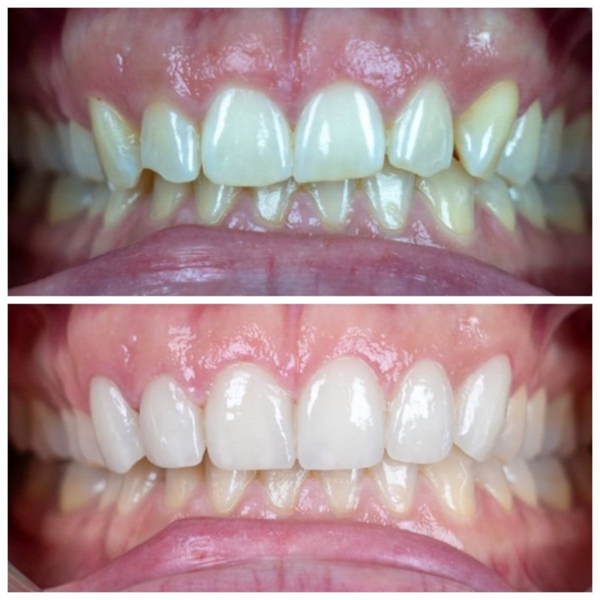 before and after photo