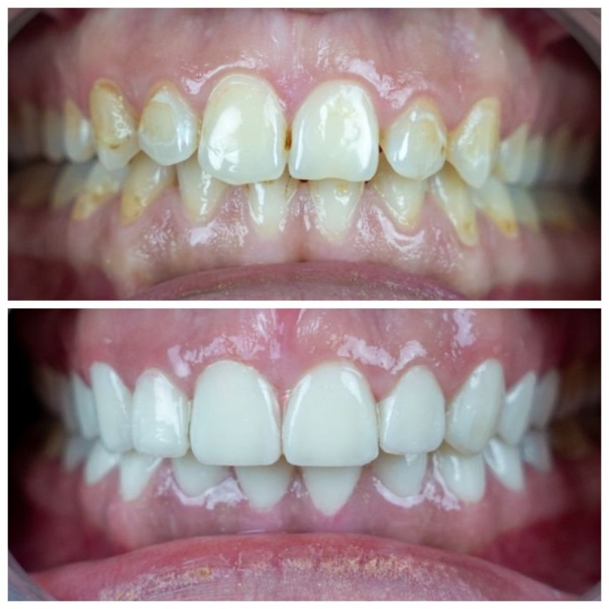 before and after photo