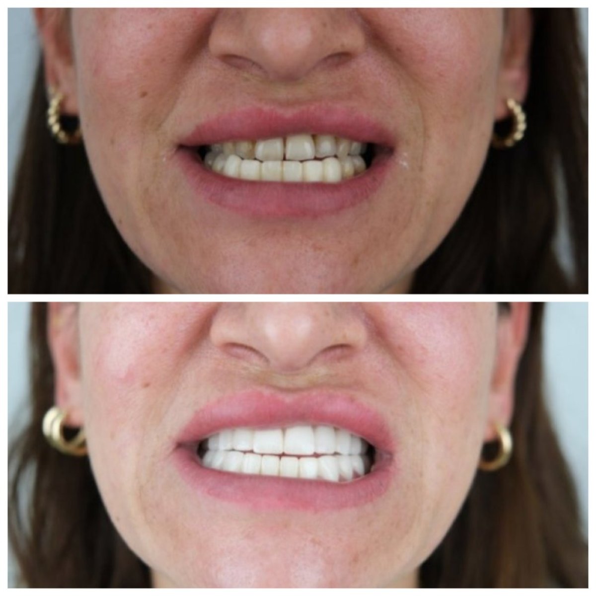 before and after photo