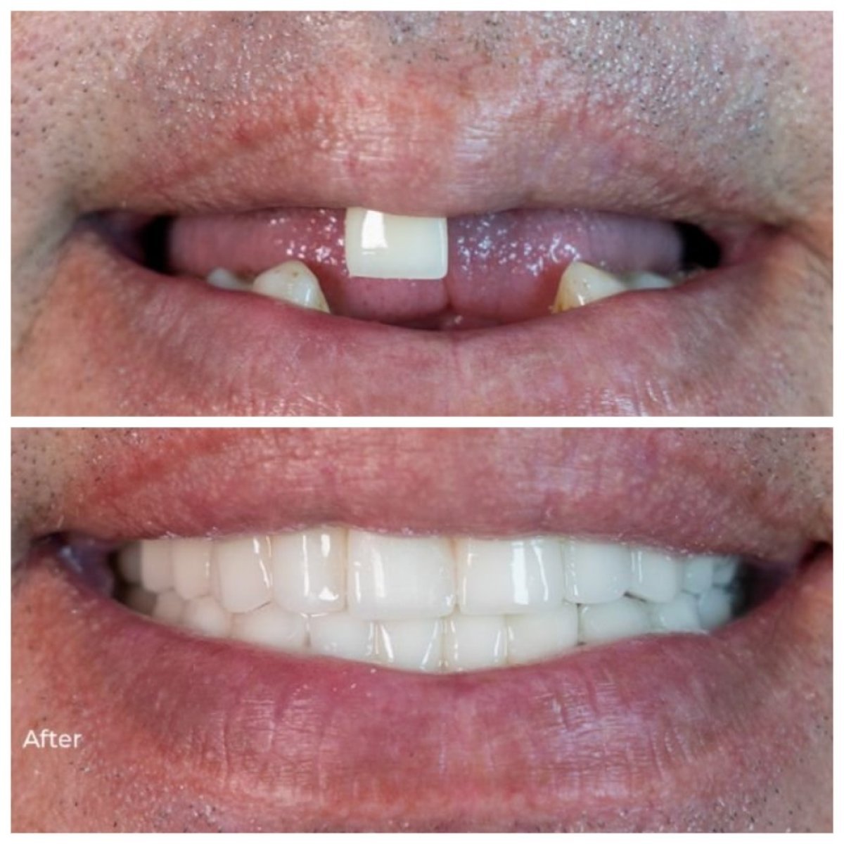 before and after photo
