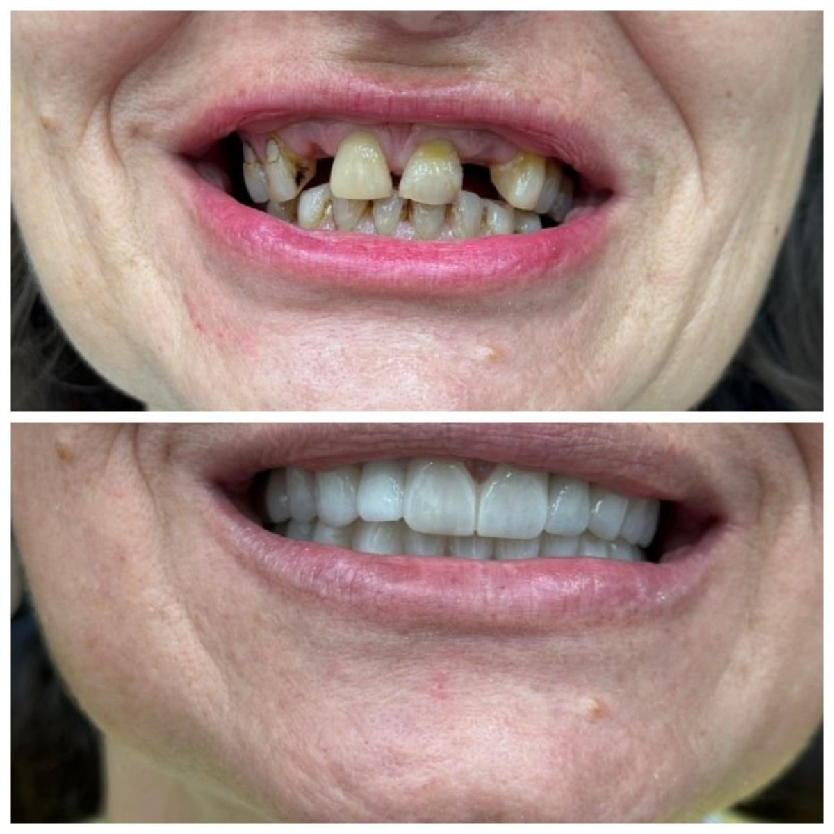 before and after photo