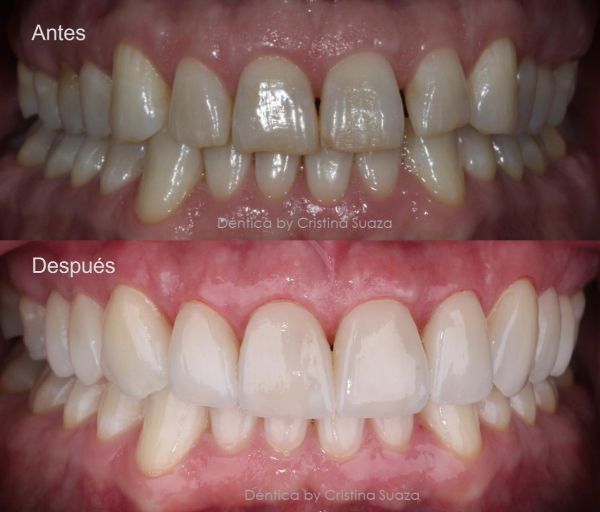 before and after photo