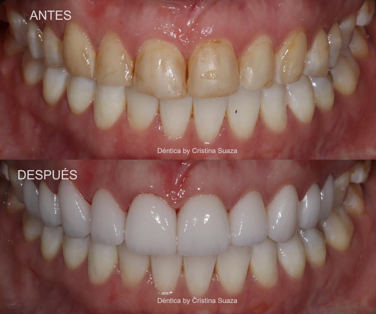 before and after photo