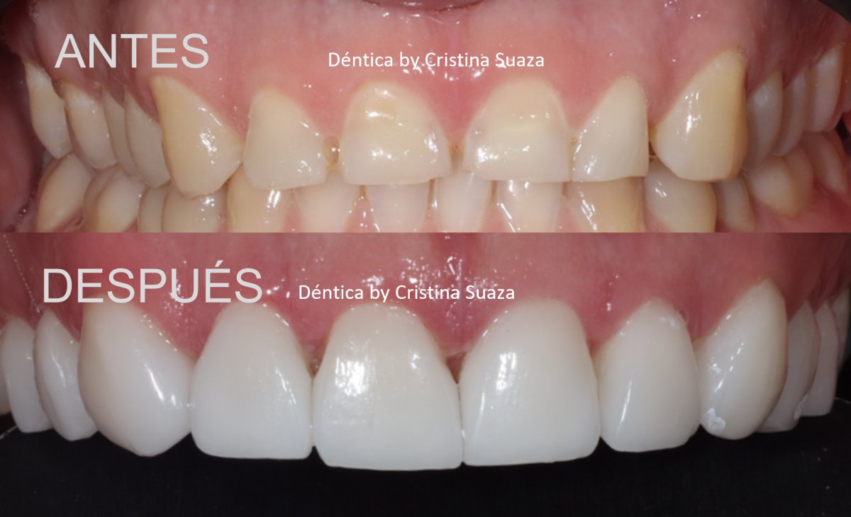 before and after photo