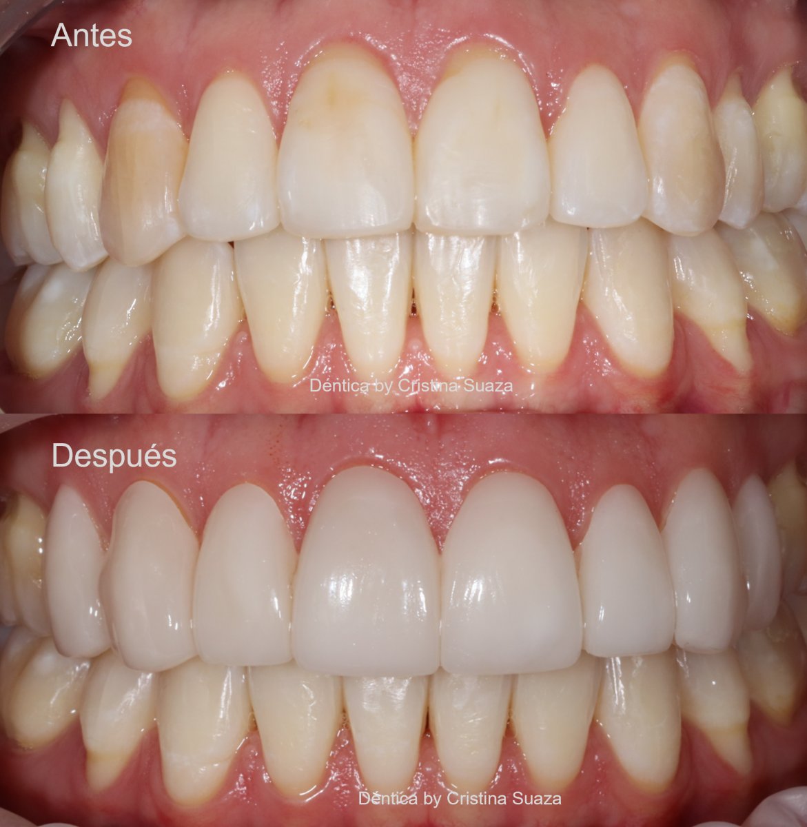 before and after photo