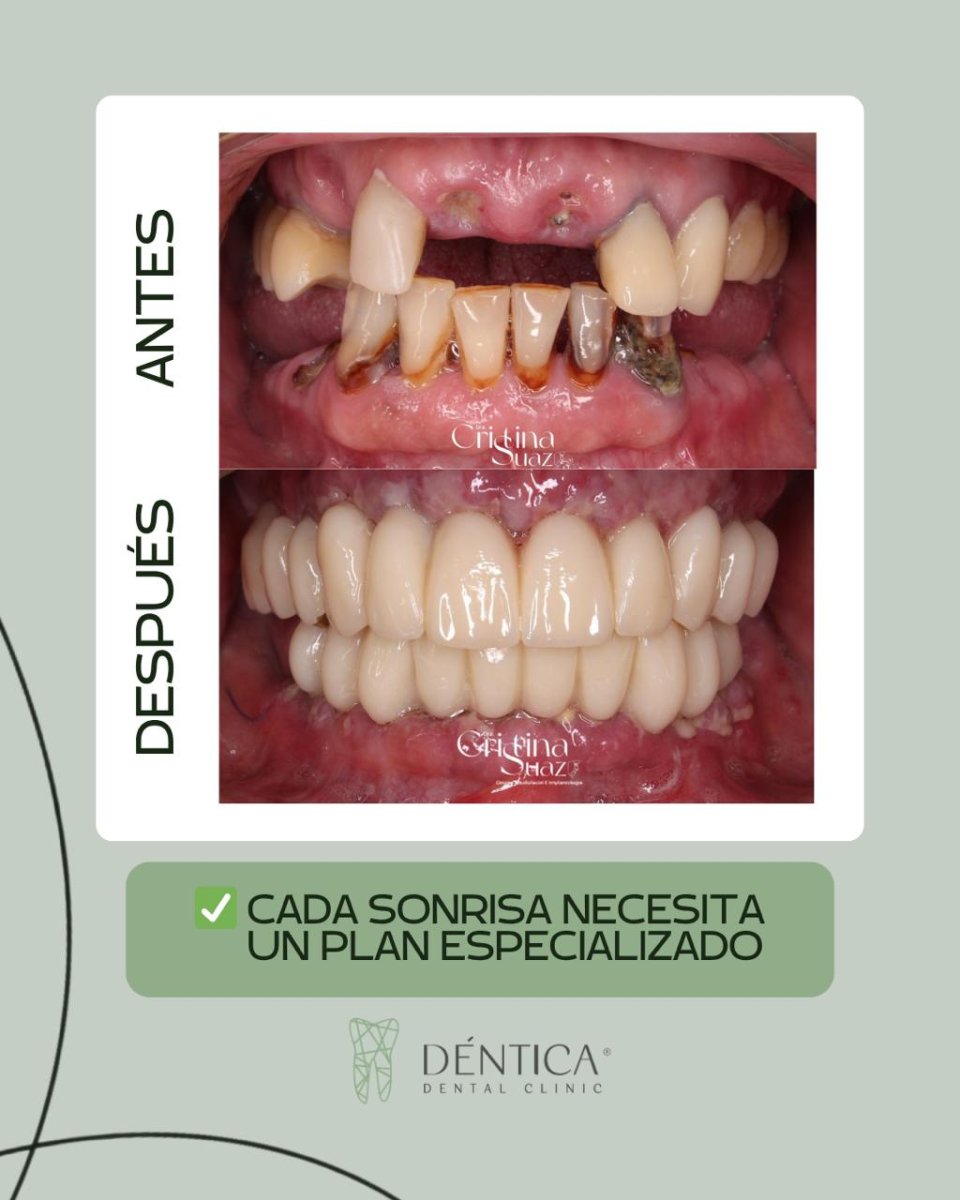 before and after photo