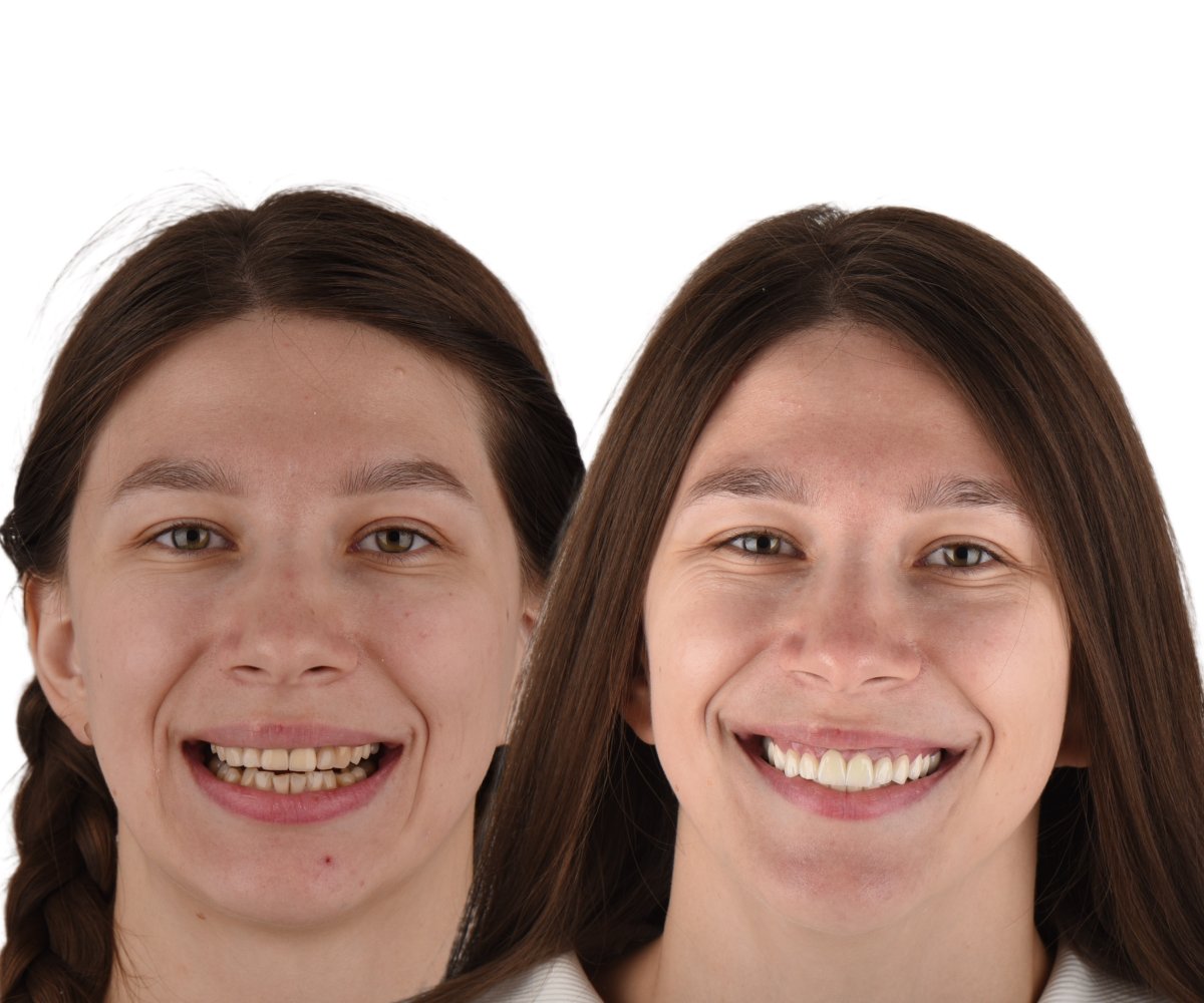 before and after photo