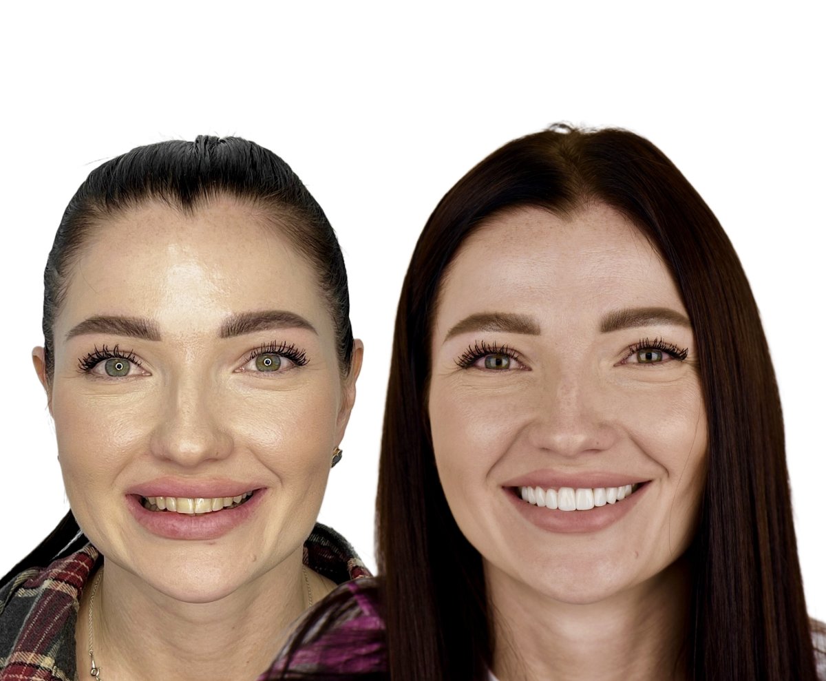 before and after photo