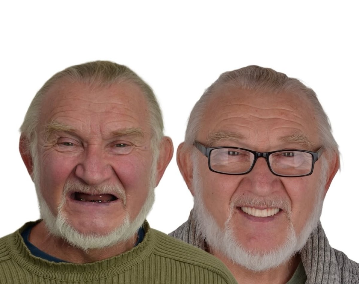 before and after photo