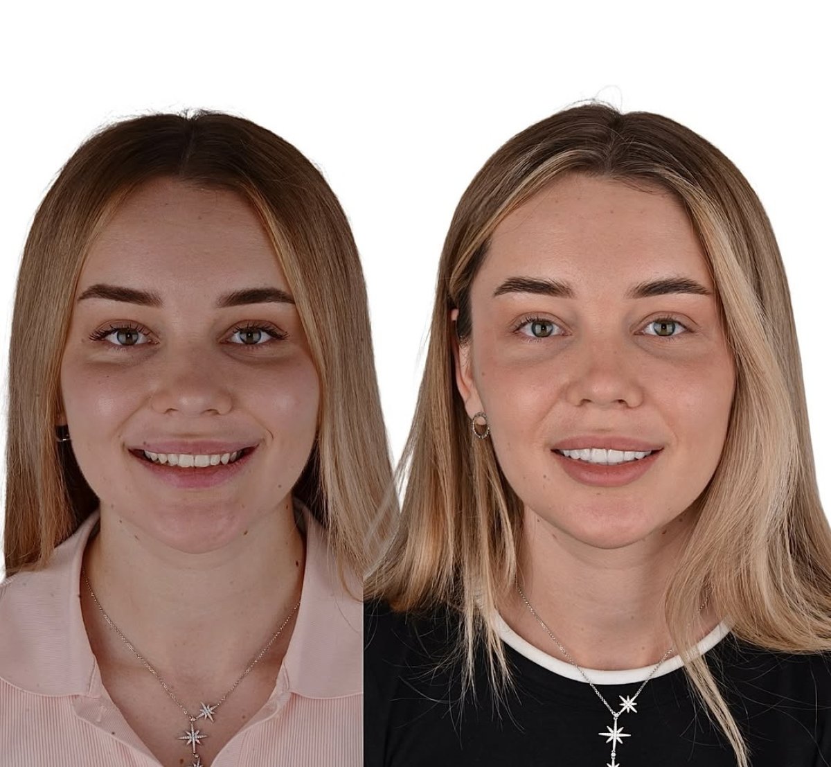 before and after photo