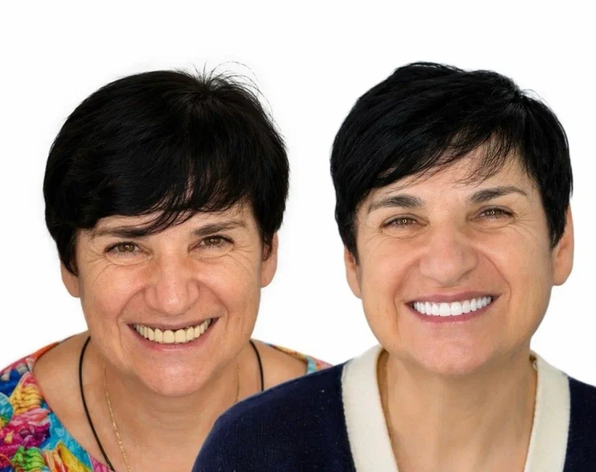 before and after photo