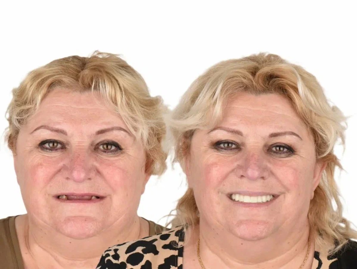 before and after photo