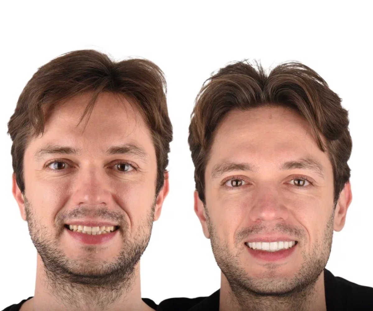before and after photo