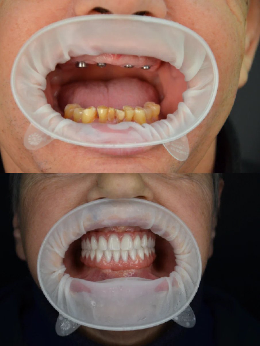 before and after photo
