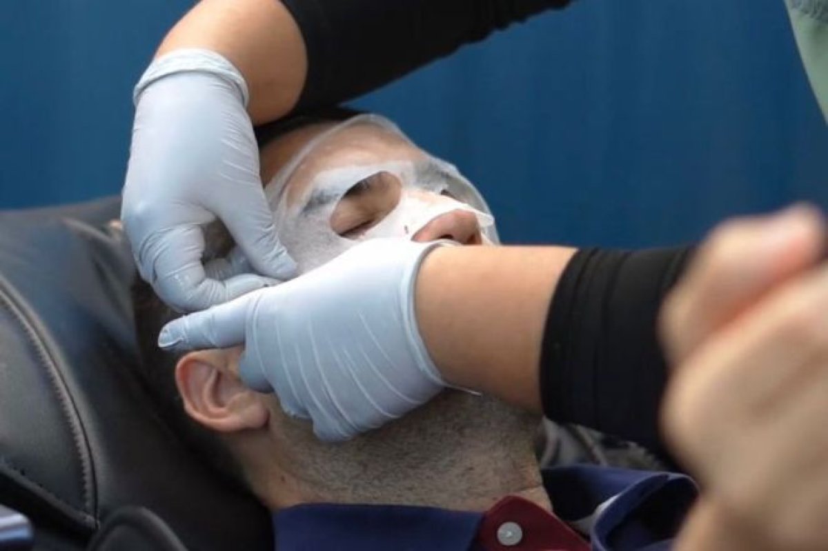 Tratamiento facial con células madre en Aesthetics Quantum Biohack Clinic, resultado rejuvenecedor