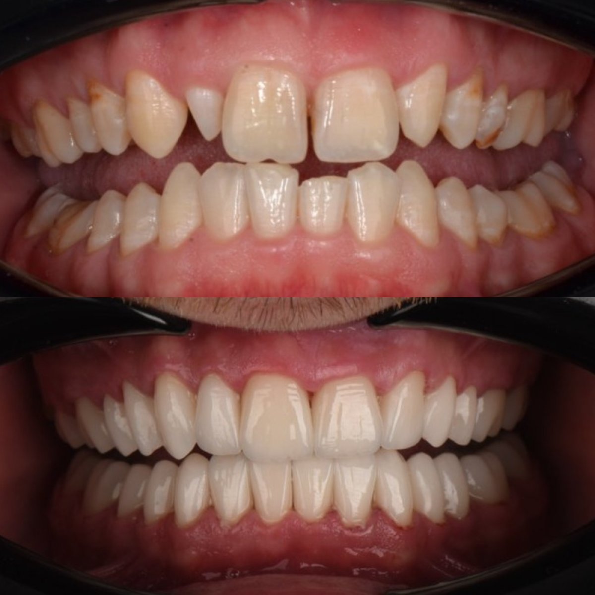 before and after photo