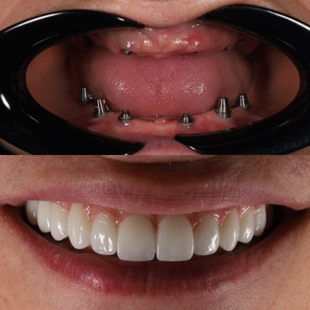 before and after photo