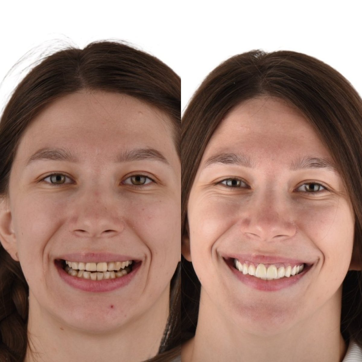 before and after photo