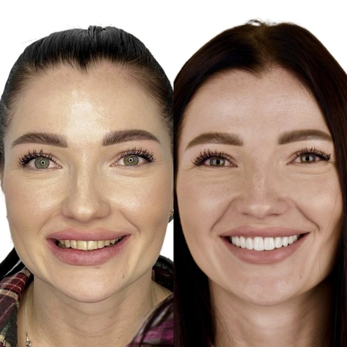 before and after photo