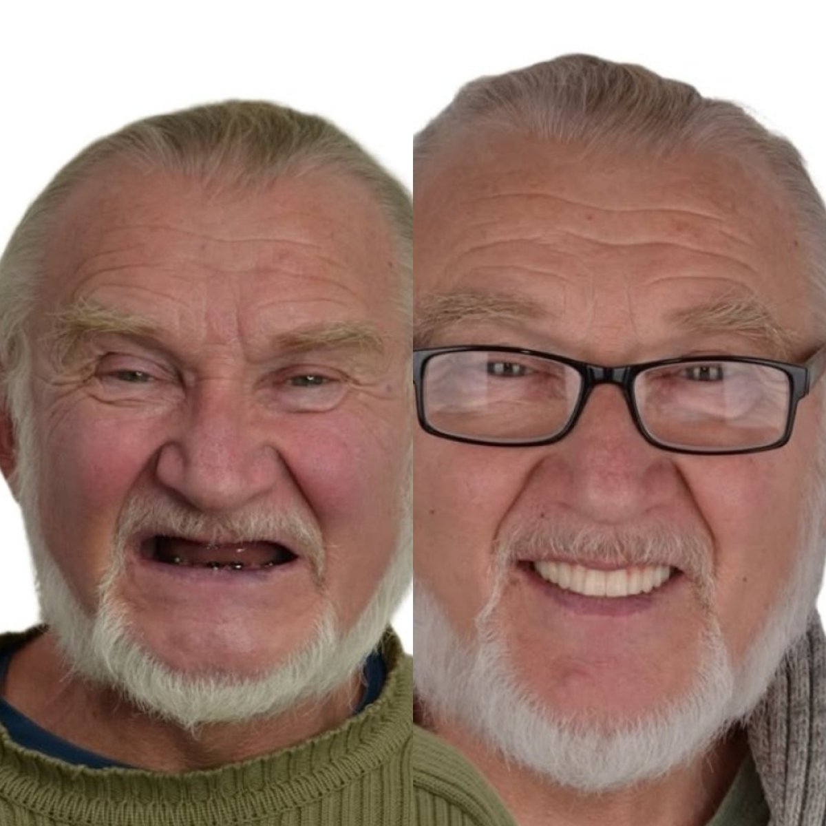 before and after photo