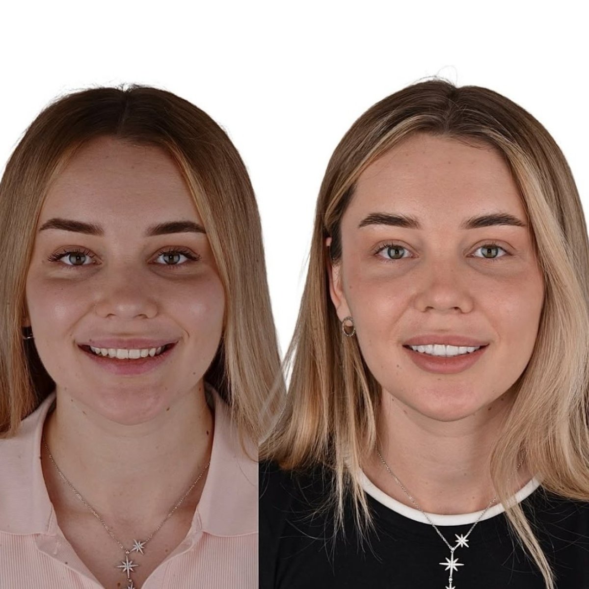 before and after photo