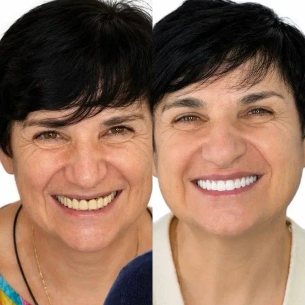 before and after photo