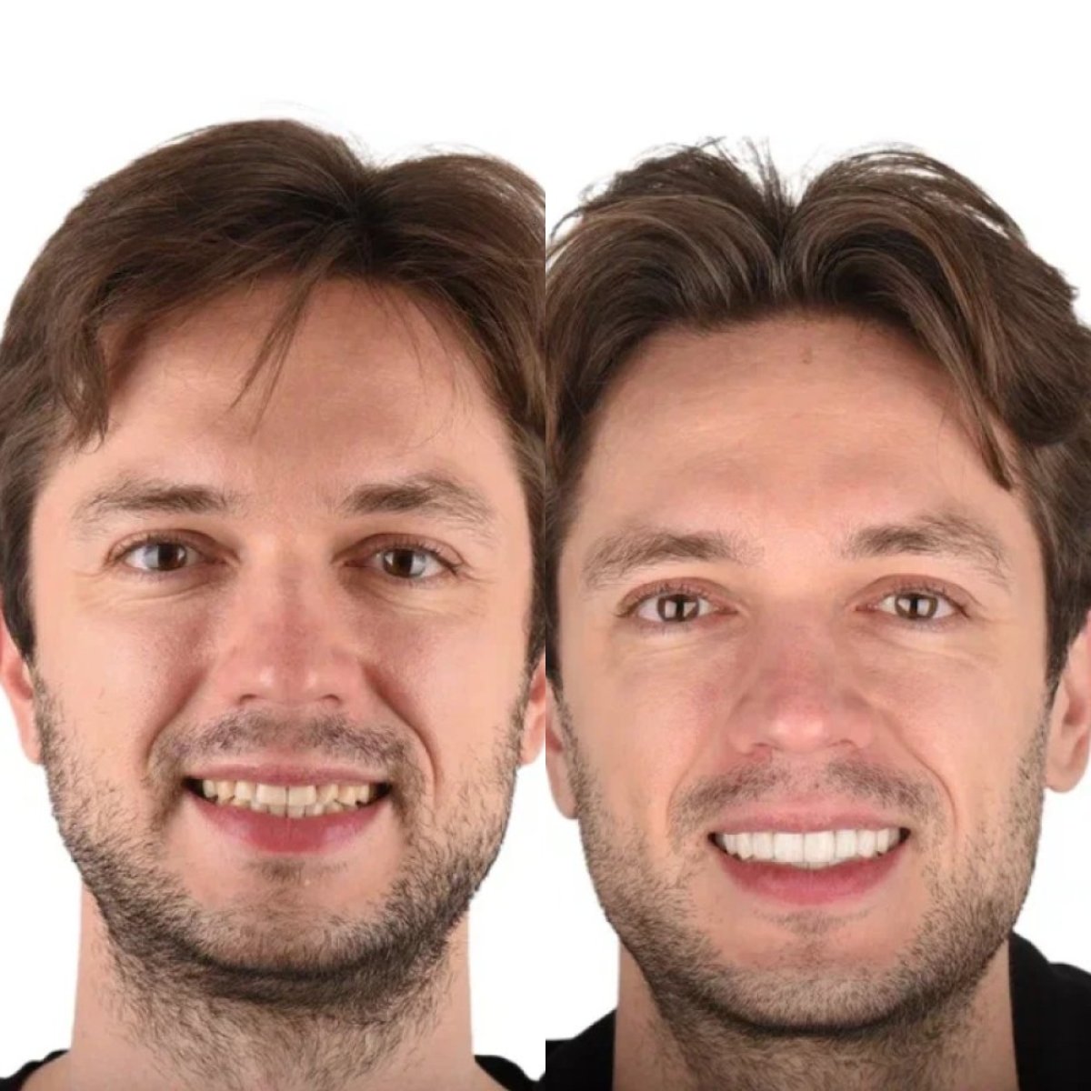 before and after photo