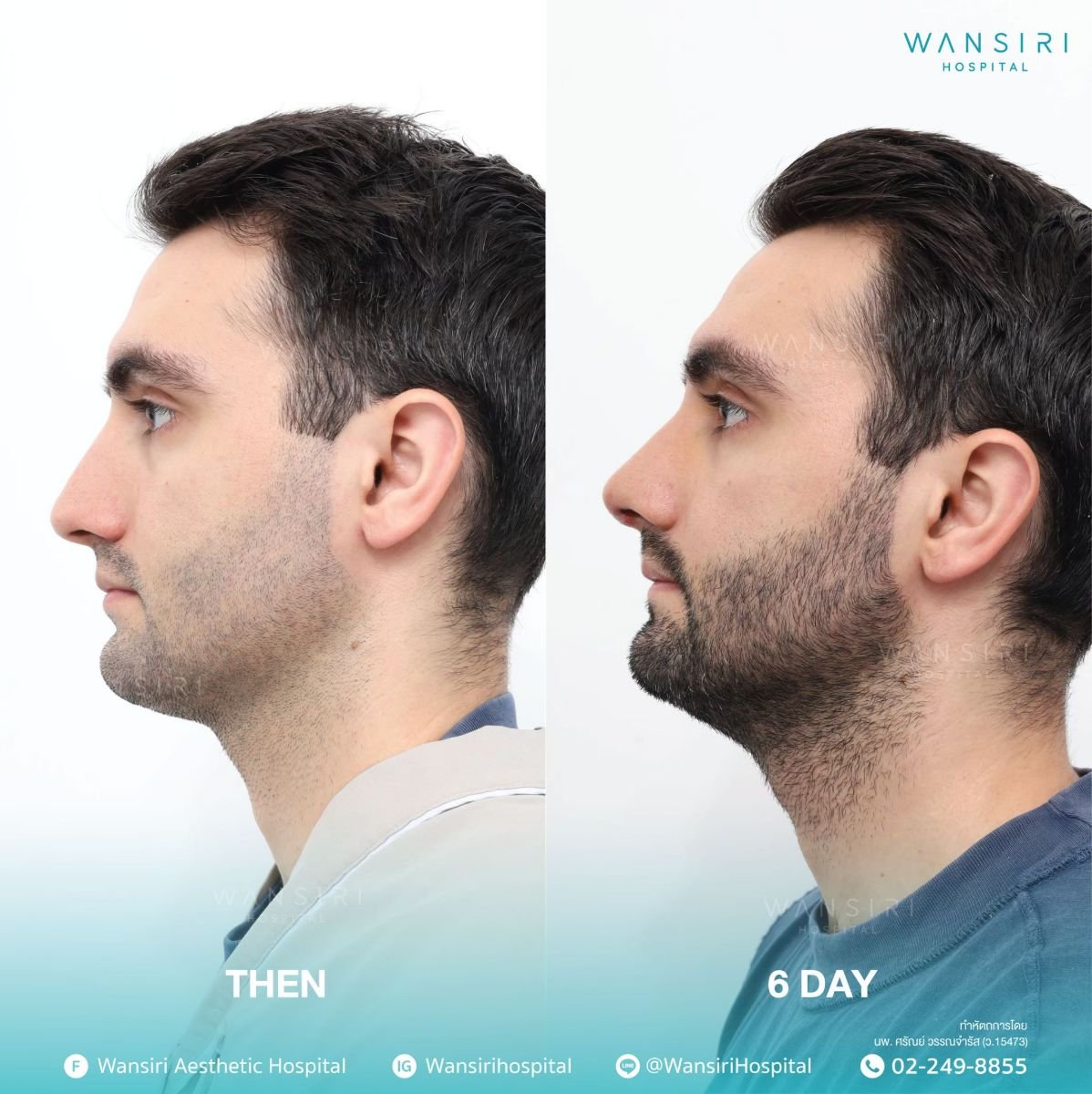 before and after photo