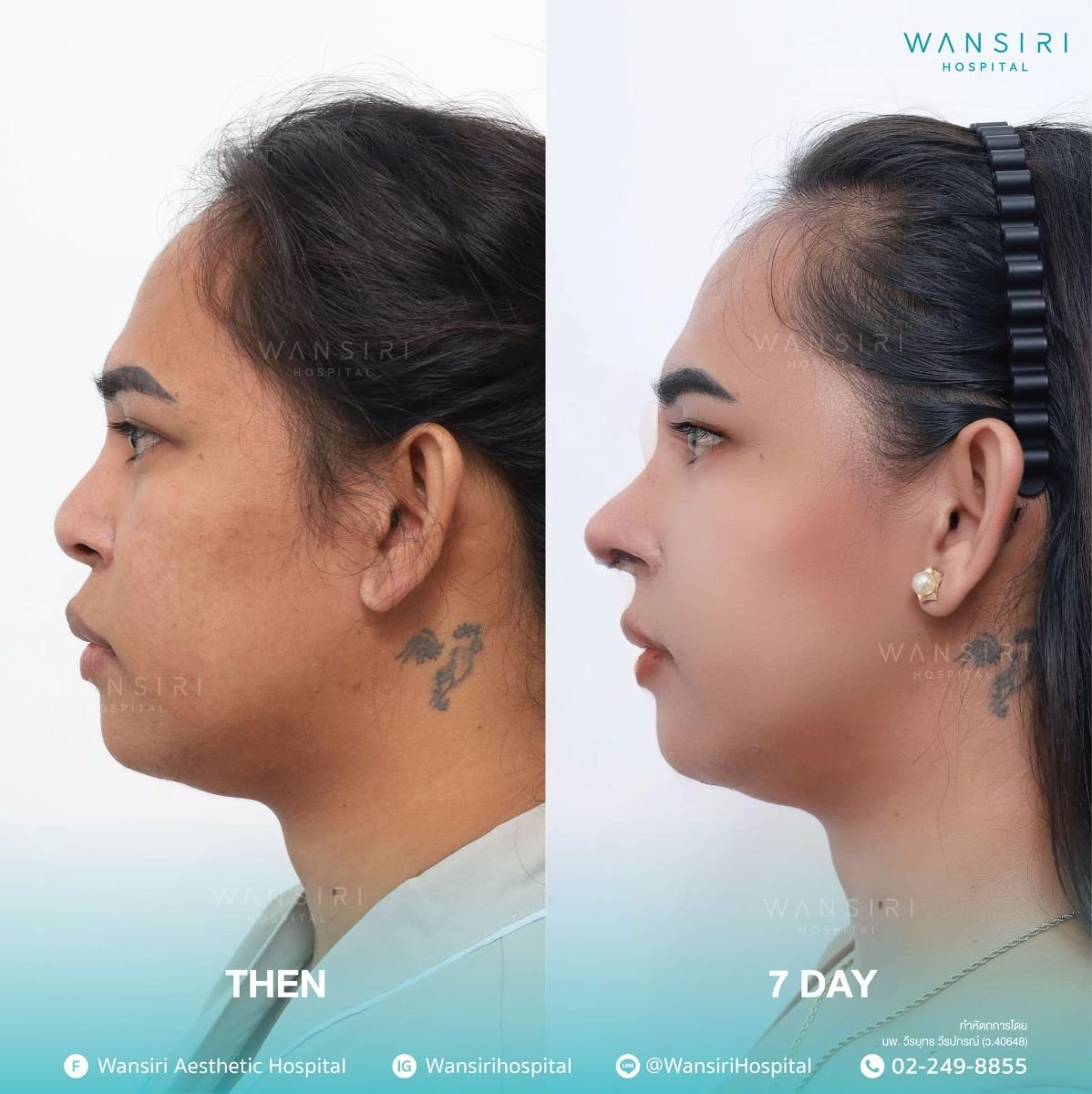 before and after photo