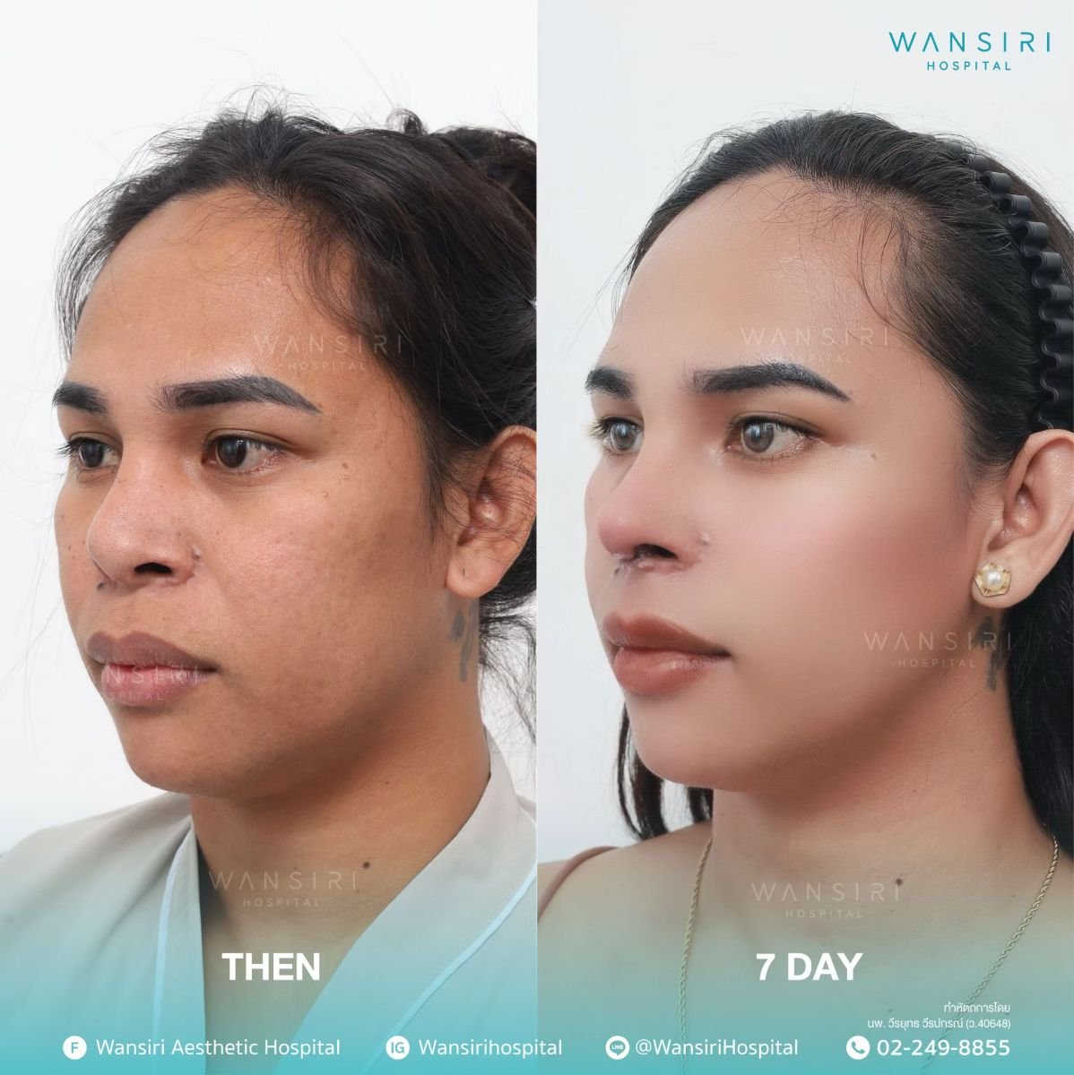 before and after photo