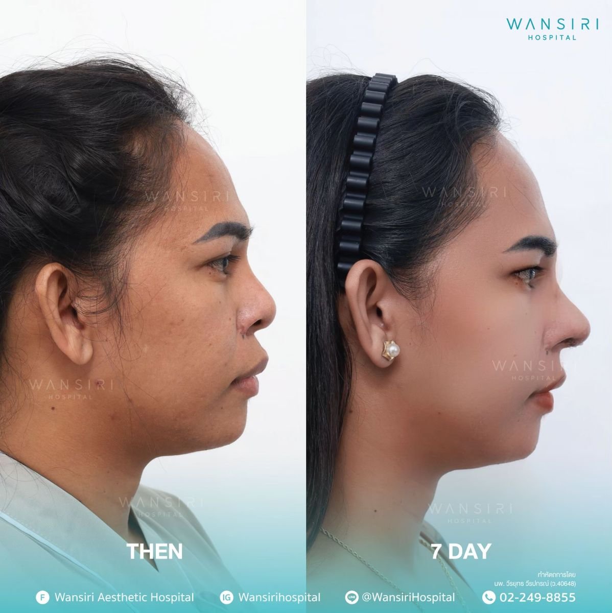 before and after photo