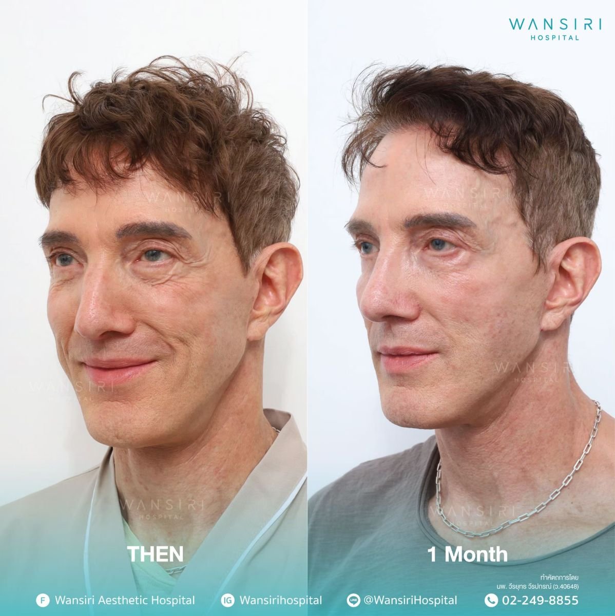 before and after photo