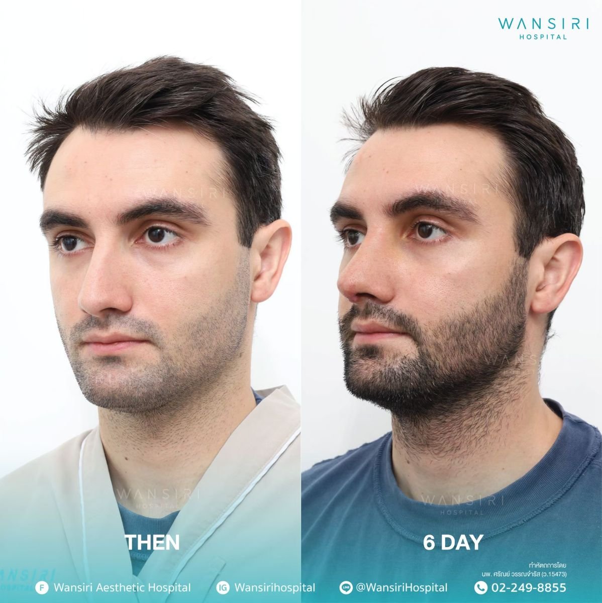 before and after photo