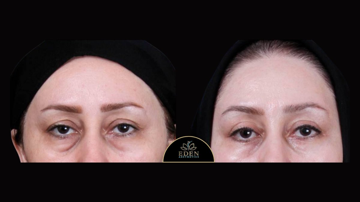 before and after photo
