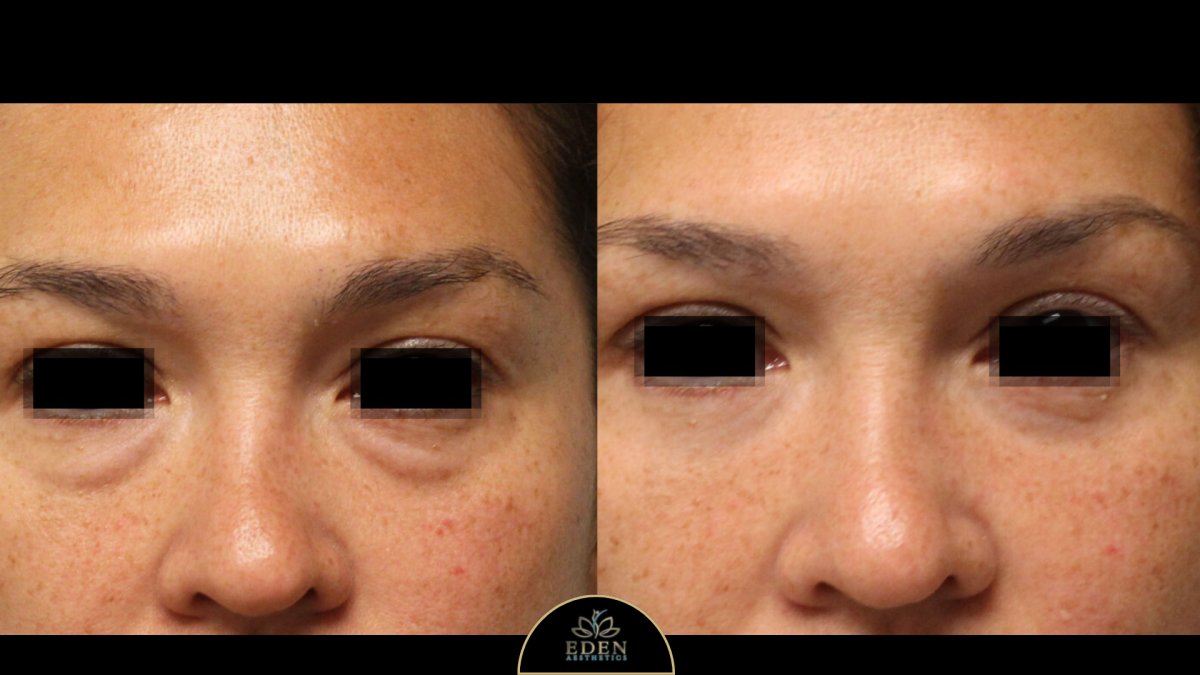 before and after photo