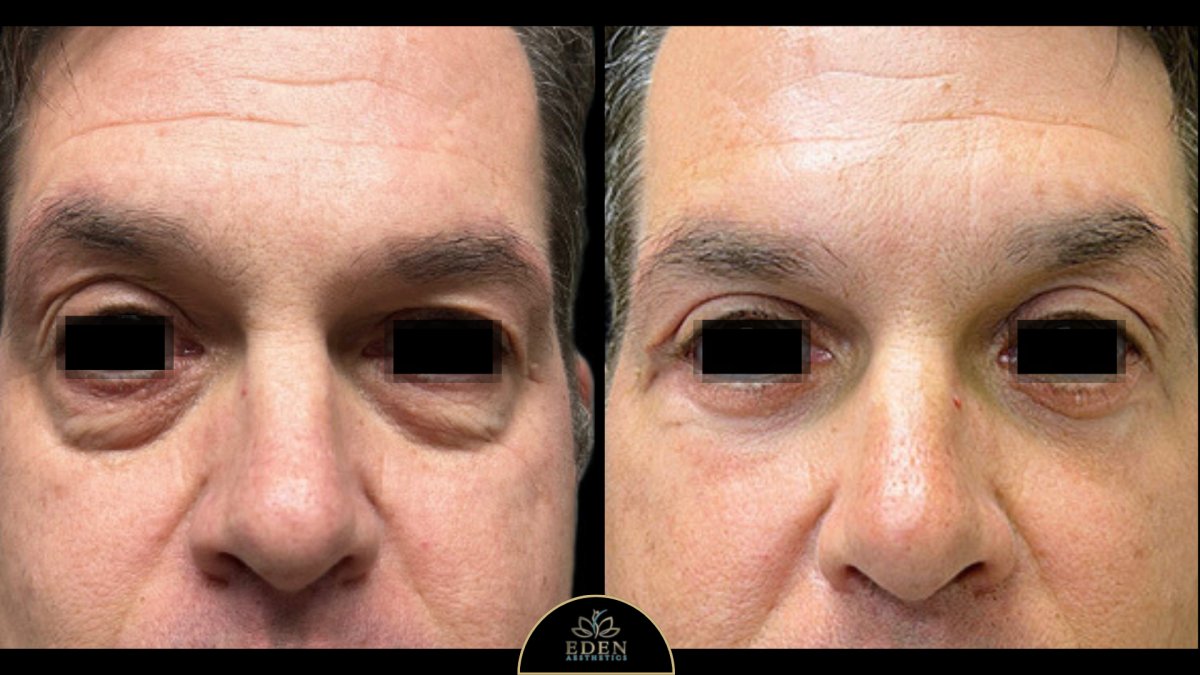 before and after photo