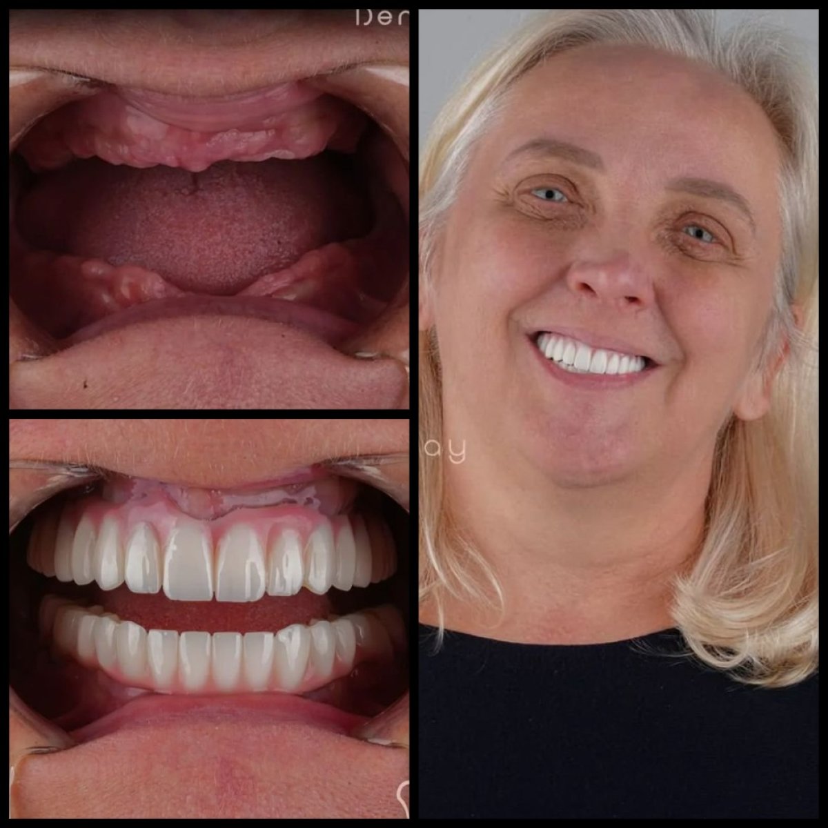 before and after photo