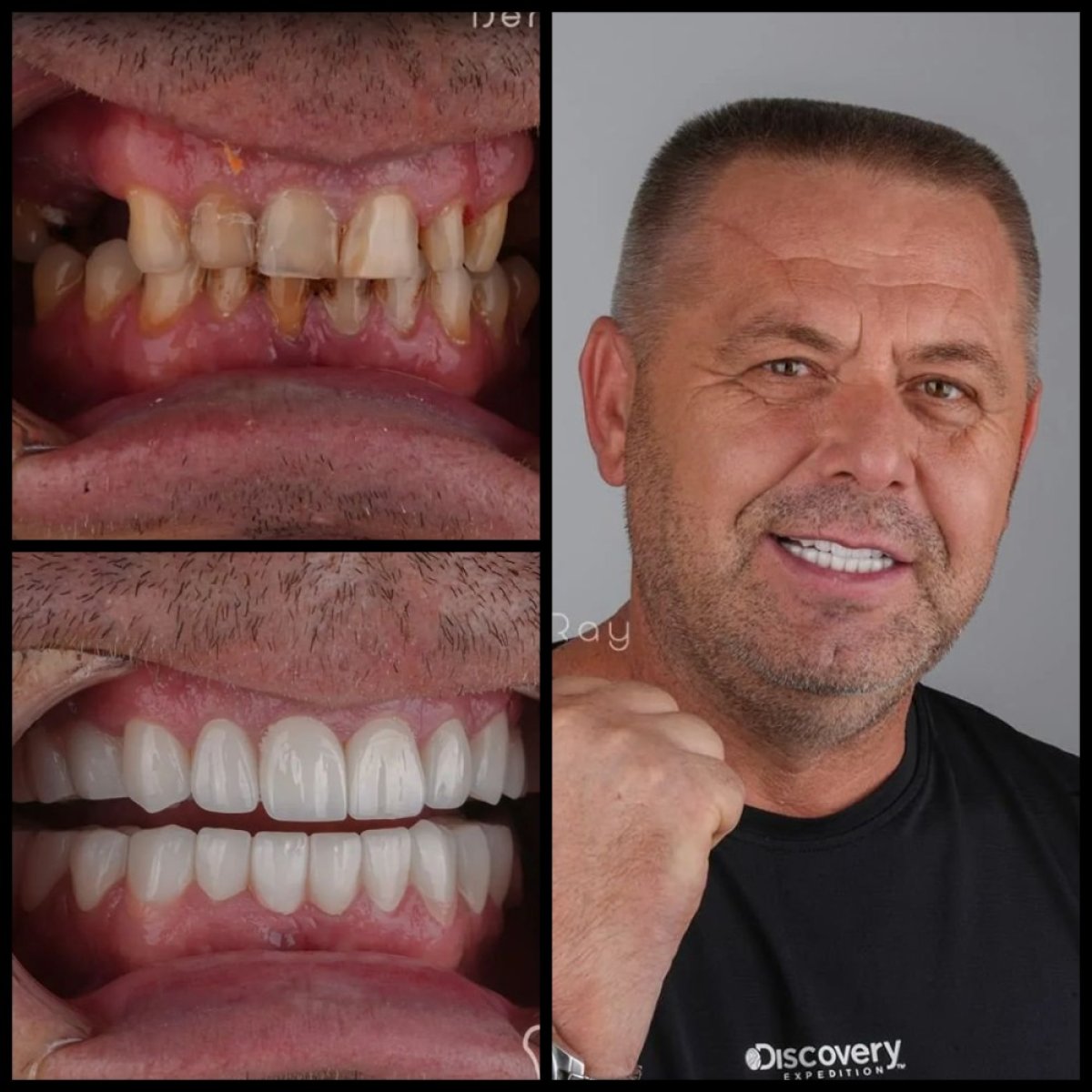 before and after photo
