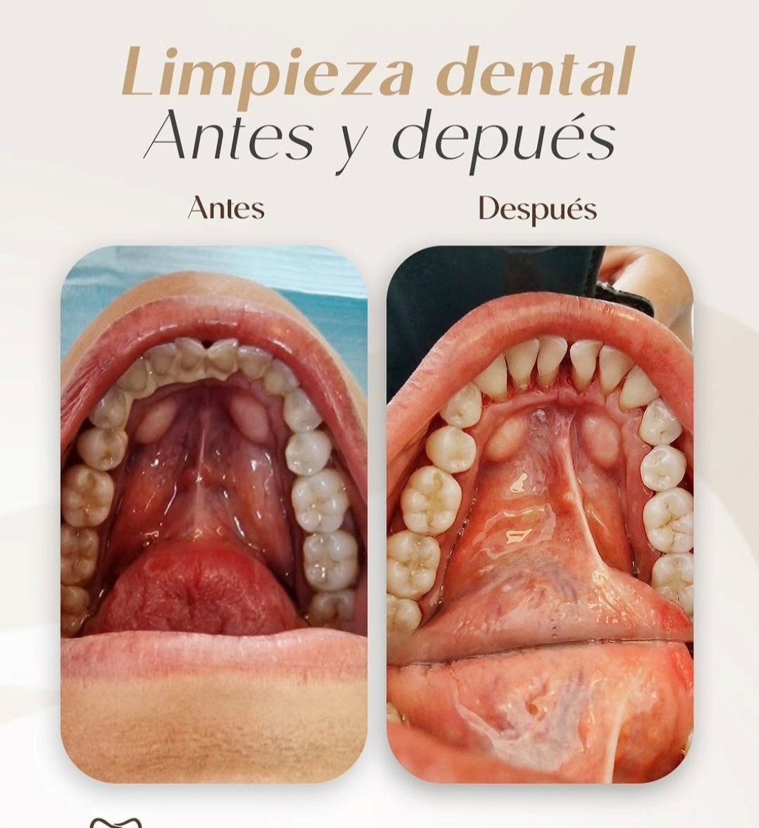 before and after photo