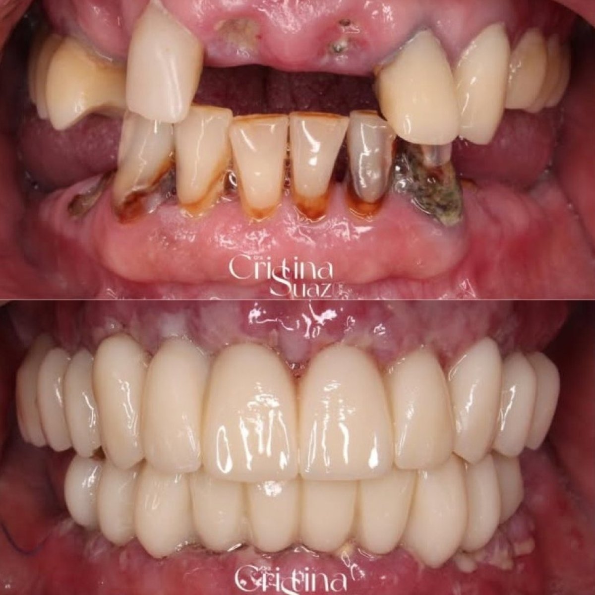 before and after photo