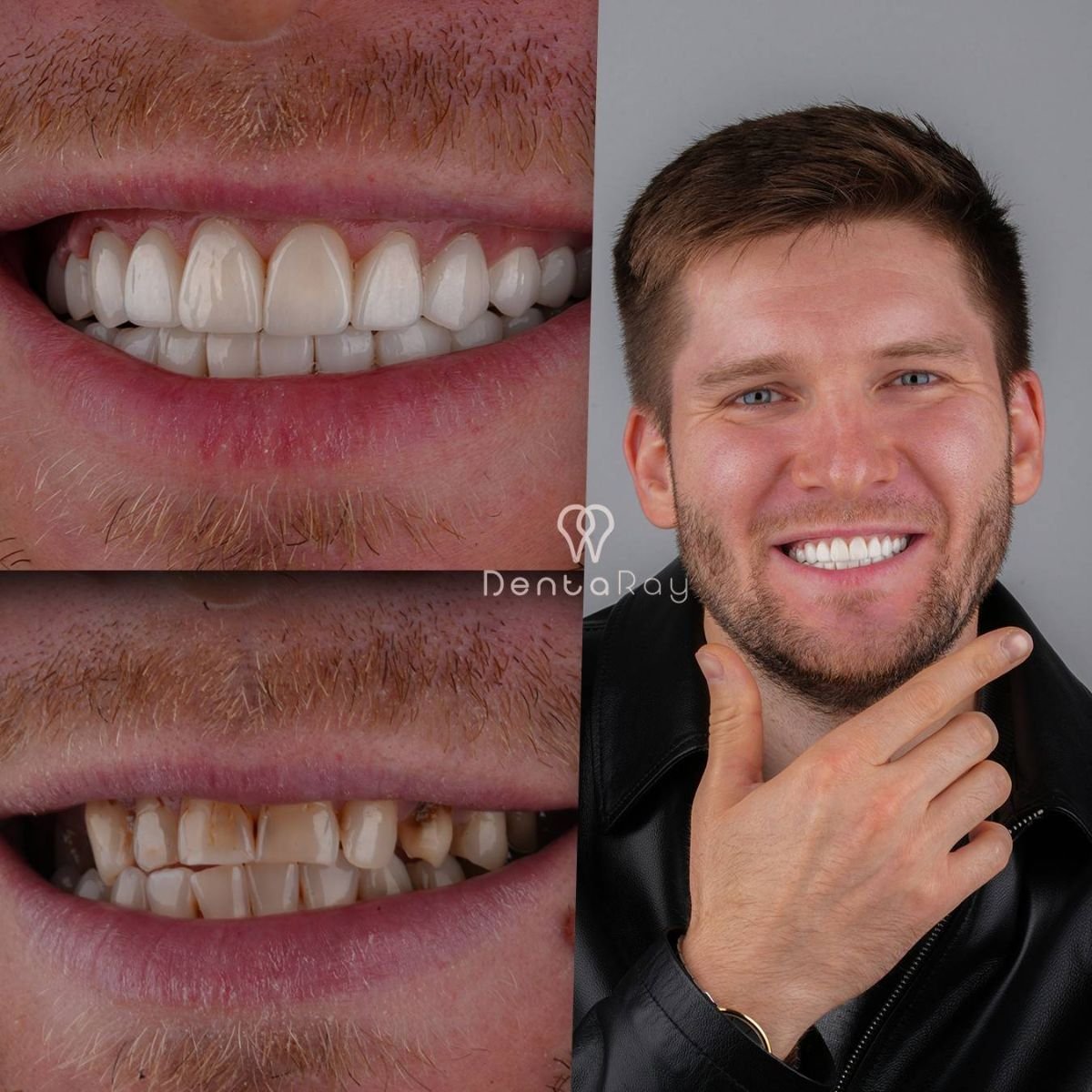 before and after photo