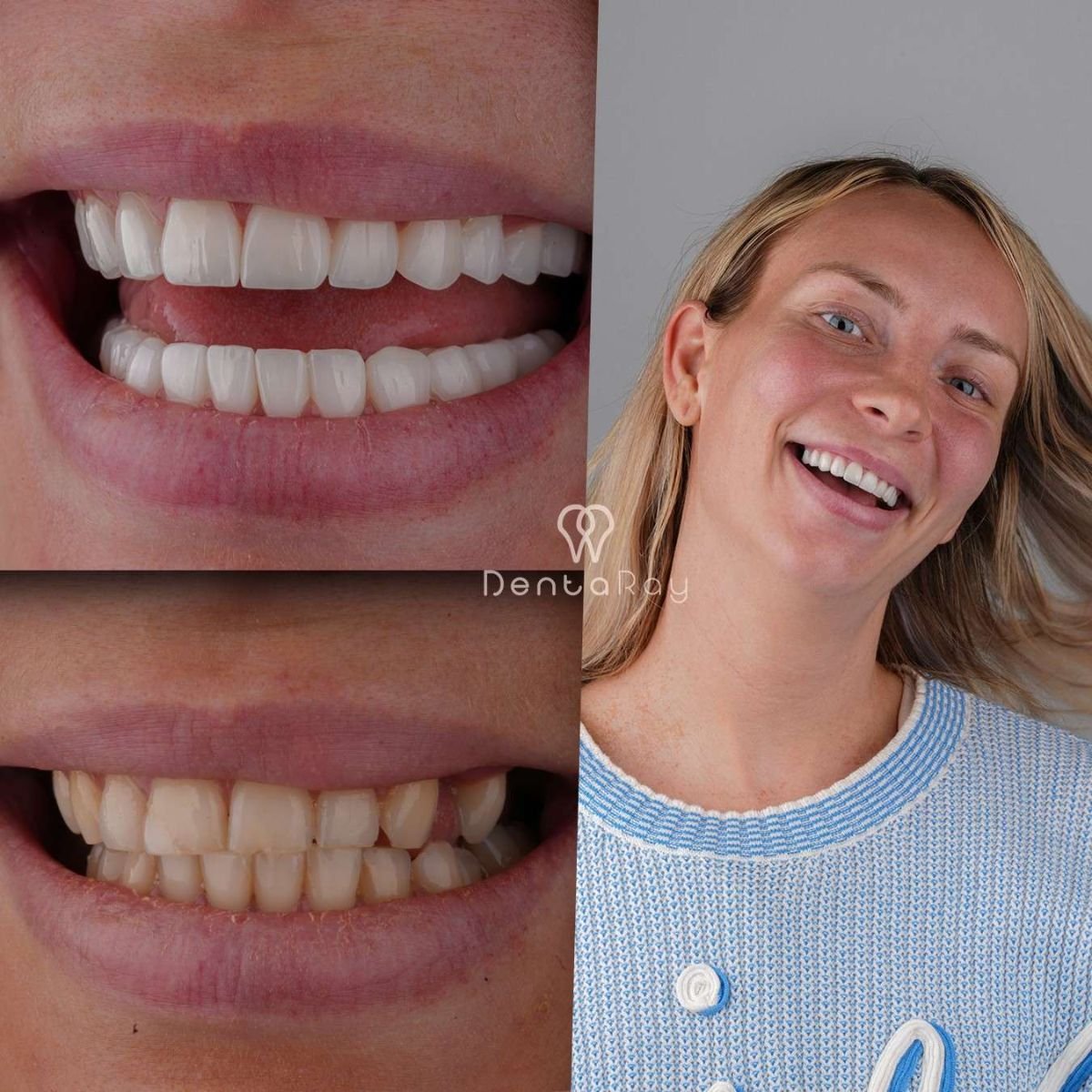 before and after photo