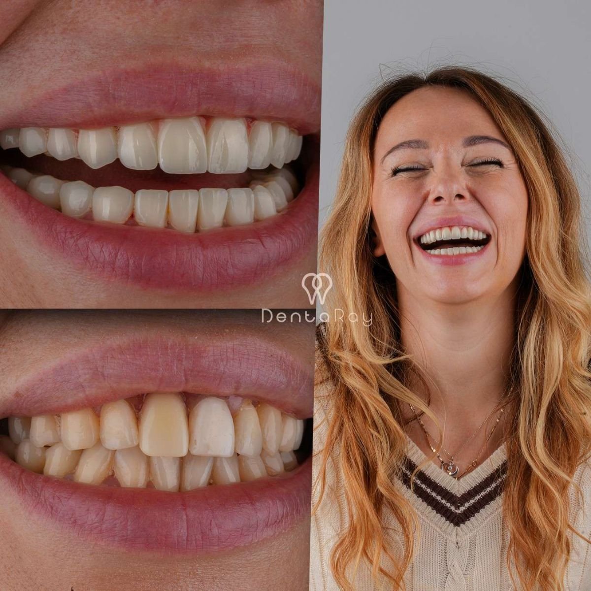 before and after photo