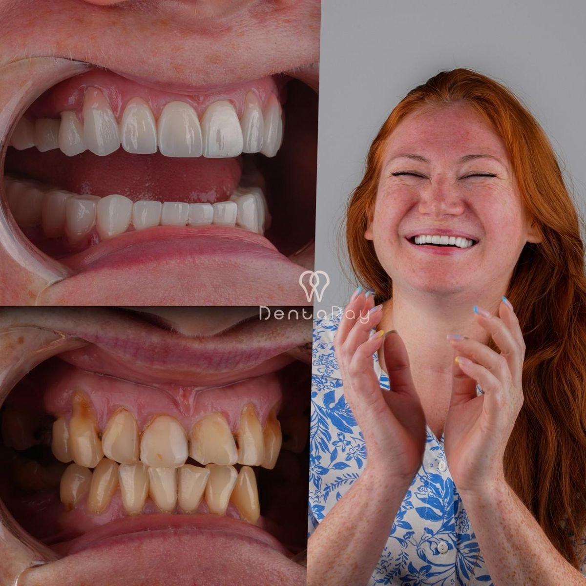 before and after photo