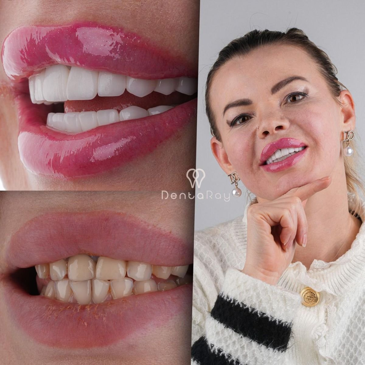 before and after photo