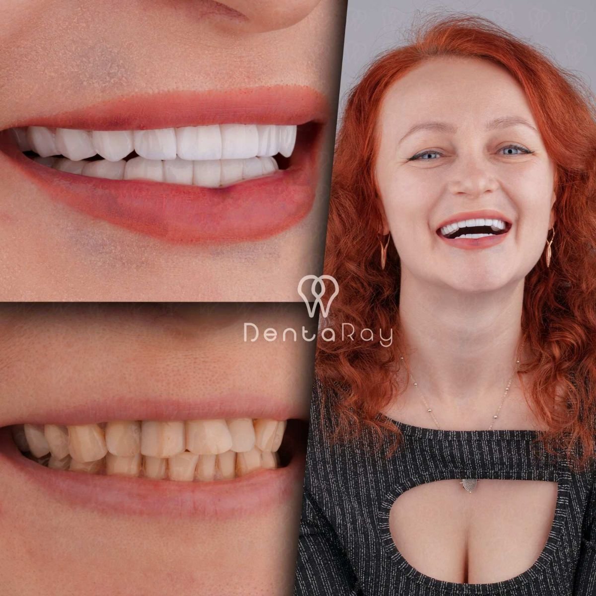 before and after photo